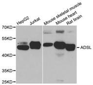 Western blot analysis of extracts of various cell lines, using ADSL antibody.
