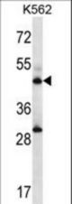 ADSS Antibody western blot of K562 cell line lysates (35 ug/lane). The ADSS antibody detected the ADSS protein (arrow).