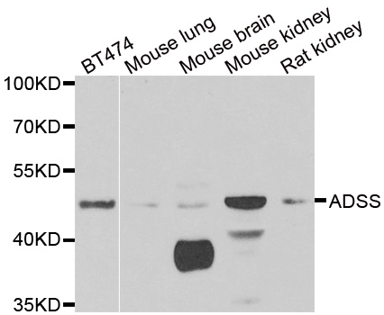 Western blot analysis of extracts of various cell lines, using ADSS antibody.