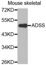 Western blot analysis of extracts of Mouse skeletal cell line, using ADSS antibody.
