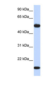 ADSSL1 antibody LS-C102304 Western blot of Fetal Muscle lysate.