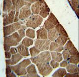 ADSSL1 antibody immunohistochemistry of formalin-fixed and paraffin-embedded human skeletal muscle followed by peroxidase-conjugated secondary antibody and DAB staining.