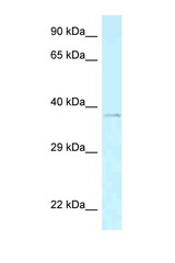 AEBP2 antibody LS-C145802 Western blot of Mouse Spleen lysate. Antibody concentration 1 ug/ml.