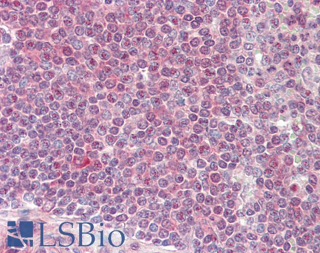 Anti-A1CF / ACF antibody IHC staining of human spleen. Immunohistochemistry of formalin-fixed, paraffin-embedded tissue after heat-induced antigen retrieval.