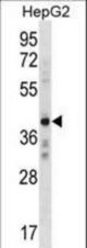 AEBP2 Antibody western blot of HepG2 cell line lysates (35 ug/lane). The AEBP2 antibody detected the AEBP2 protein (arrow).
