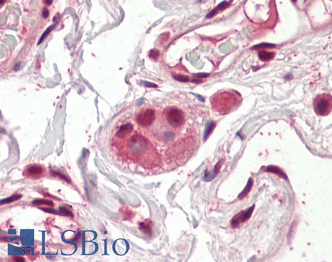 Anti-Groucho antibody IHC of human colon, submucosal plexus. Immunohistochemistry of formalin-fixed, paraffin-embedded tissue after heat-induced antigen retrieval. Antibody LS-B8362 dilution 3.75 ug/ml.