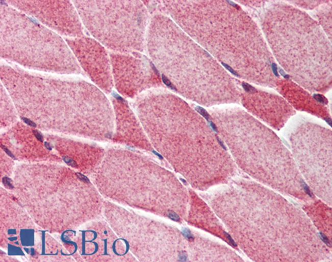 Anti-AES antibody IHC of human skeletal muscle. Immunohistochemistry of formalin-fixed, paraffin-embedded tissue after heat-induced antigen retrieval. Antibody LS-B441 concentration 5 ug/ml.