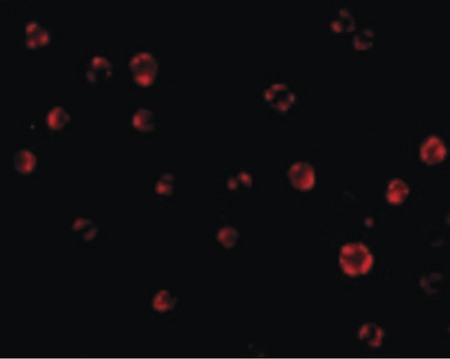Immunofluorescence of AES in HeLa cells with AES antibody at 20 ug/ml.