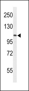 Western blot of AF5q31 Antibody in HL-60 cell line lysates (35 ug/lane). AF5q31 (arrow) was detected using the purified antibody.