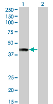 Western blot of AFF4 expression in transfected 293T cell line by AFF4 monoclonal antibody (M01), clone 2E12.