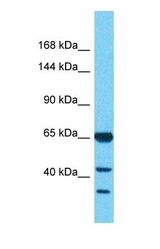 Western blot of AFF4 Antibody with human Placenta lysate.