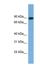 AFAP1 antibody LS-C112072 Western blot of Fetal Liver lysate.