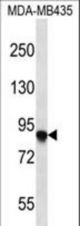 AFAP1 Antibody western blot of MDA-MB435 cell line lysates (35 ug/lane). The AFAP1 antibody detected the AFAP1 protein (arrow).