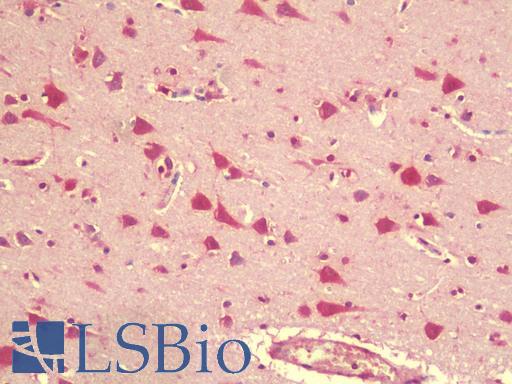 Anti-AFAP1 / AFAP antibody IHC staining of human brain, cortex. Immunohistochemistry of formalin-fixed, paraffin-embedded tissue after heat-induced antigen retrieval. Antibody LS-B9578 concentration 5 ug/ml.