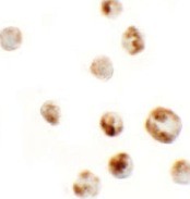 Immunocytochemistry of AFAP1L in A549 cells with AFAP1L antibody at 5 µg/mL.