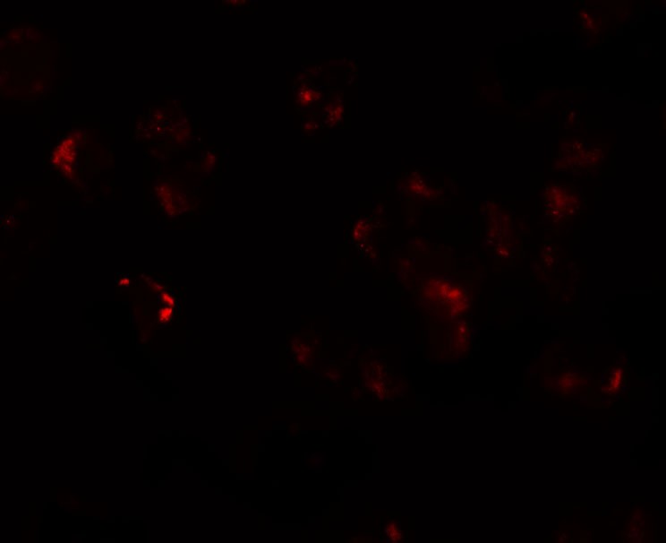 Immunofluorescence of AFAP1L in A549 cells with AFAP1L antibody at 20 µg/mL.
