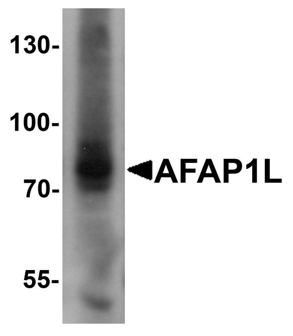 Western blot analysis of AFAP1L1 in A549 cell lysate with AFAP1L1 antibody at 1 ug/ml.