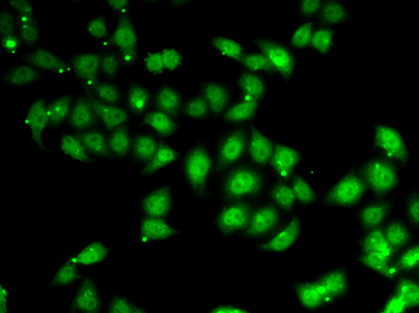 Immunofluorescence blot of U20S cell using AFF1 antibody.