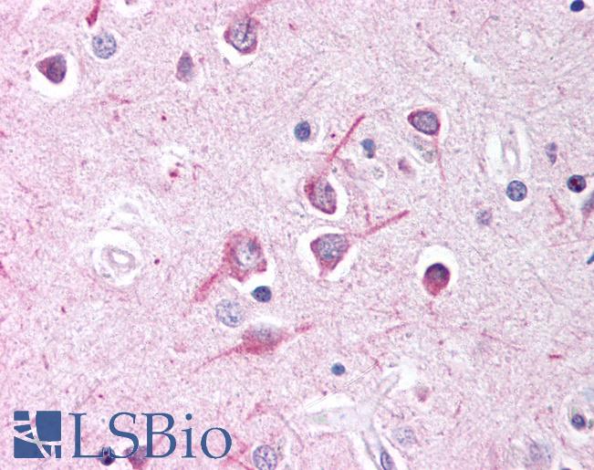 Anti-AFF1 antibody IHC of human brain, cortex. Immunohistochemistry of formalin-fixed, paraffin-embedded tissue after heat-induced antigen retrieval. Antibody LS-B796 concentration 10 ug/ml.