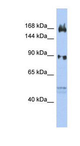 AFF2 antibody LS-C109886 Western blot of OVCAR-3 cell lysate.