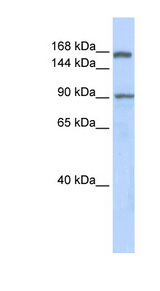 AFF2 antibody LS-C101676 Western blot of Fetal Lung lysate.