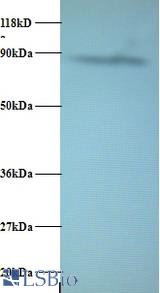 Western blot of AFG3-like protein 2 Antibody at 2 ug/ml + EC109 whole cell lysate at 20 ug. Secondary: Goat polyclonal to Rabbit IgG at 1:15000 dilution. Predicted band size: 87.7 kDa. Observed band size: 87.7 kDa.