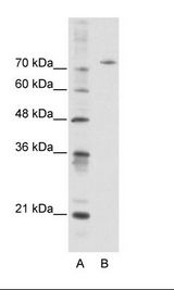 A: Marker, B: HepG2 Cell Lysate