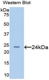 Western blot of recombinant AFM / Afamin.