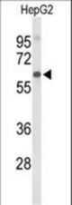 Western blot of AFM Antibody in HepG2 cell line lysates (35 ug/lane). AFM (arrow) was detected using the purified antibody.