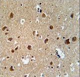 AFTPH Antibody immunohistochemistry of formalin-fixed and paraffin-embedded human brain tissue followed by peroxidase-conjugated secondary antibody and DAB staining.