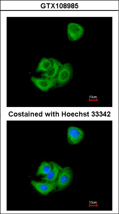 Immunofluorescence of methanol-fixed A549 using AGR3 antibody at 1:200 dilution.
