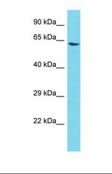 Western blot of Human HepG2. AGAP11 antibody dilution 1.0 ug/ml.