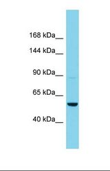 Western blot of Human Hela. AGAP11 antibody dilution 1.0 ug/ml.