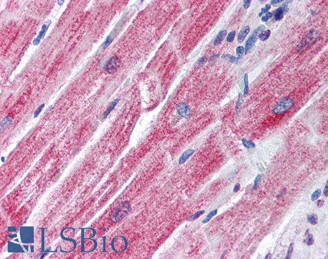 Anti-AGAP2 / PIKE antibody IHC of human heart. Immunohistochemistry of formalin-fixed, paraffin-embedded tissue after heat-induced antigen retrieval. Antibody LS-B134 concentration 20 ug/ml.