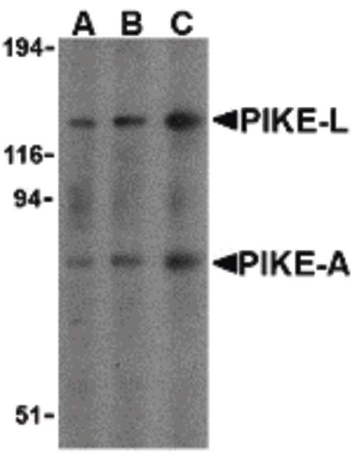 Western blot of PIKE in mouse brain cell lysates with PIKE antibody at (A) 0.5, (B) 1, and (C) 2 ug/ml.