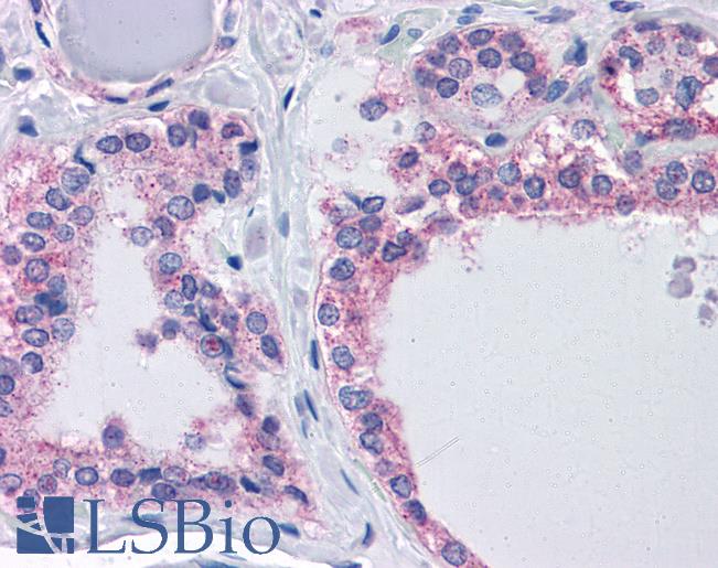 Anti-AGAP2 / PIKE antibody IHC of human thyroid. Immunohistochemistry of formalin-fixed, paraffin-embedded tissue after heat-induced antigen retrieval. Antibody LS-B4387 concentration 3.75 ug/ml.
