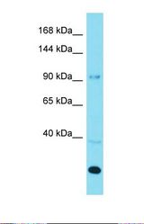 Western blot of Human 293T. AGAP3 antibody dilution 1.0 ug/ml.