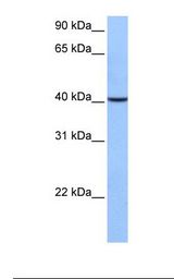 Fetal liver cell lysate. Antibody concentration: 1.0 ug/ml. Gel concentration: 12%.