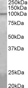 AGBL5 antibody (1 ug/ml) staining of Mouse Skin lysate (35 ug protein in RIPA buffer). Primary incubation was 1 hour. Detected by chemiluminescence.