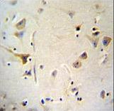 AGBL5 Antibody immunohistochemistry of formalin-fixed and paraffin-embedded human brain tissue followed by peroxidase-conjugated secondary antibody and DAB staining.
