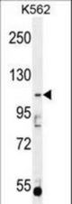 AGBL5 Antibody western blot of K562 cell line lysates (35 ug/lane). The AGBL5 antibody detected the AGBL5 protein (arrow).