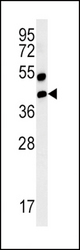 Western blot of AGER-K44 in mouse lung tissue lysates (35 ug/lane). AGER (arrow) was detected using the purified antibody.