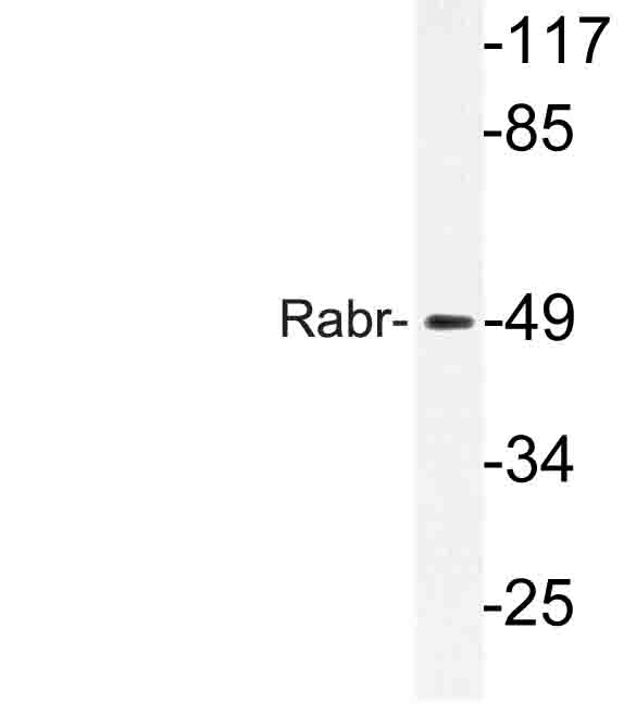 Western blot of Rabr (V131) pAb in extracts from MCF-7cells.