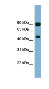 AGK antibody LS-C111992 Western blot of Fetal Brain lysate.