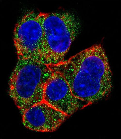 Confocal immunofluorescent of AGL Antibody with HepG2 cell followed by Alexa Fluor 488-conjugated goat anti-rabbit lgG (green). Actin filaments have been labeled with Alexa Fluor 555 phalloidin (red). DAPI was used to stain the cell nuclear (blue).