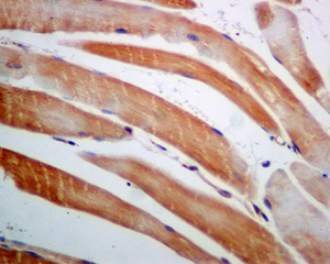 IHC of paraffin-embedded human muscle tissue using anti-AGL antibody.