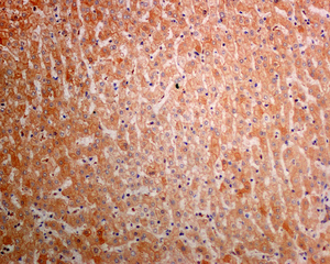 IHC of paraffin-embedded human liver tissue using anti-AGL antibody.
