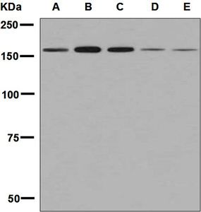 Western blot analysis on (A) fetal muscle, (B) mouse muscle, (C) fetal heart, (D) K562, and (E) 293T cell lysates using anti-AGL antibody.