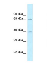 AGMAT antibody LS-C145726 Western blot of Fetal Brain lysate. Antibody concentration 1 ug/ml.