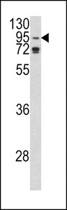 Western blot of AGO1 Antibody in K562 cell line lysates (35 ug/lane). AGO1 (arrow) was detected using the purified antibody.